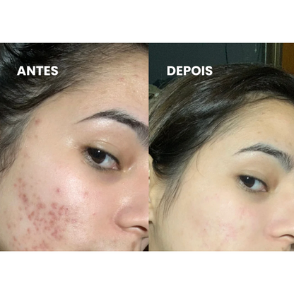 ESSÊNCIA COREANA: KIT 5PCS SKIN CARE MOISTURIZER + BRINDE